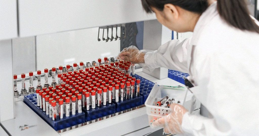 Alzheimer's blood tests show 'very good accuracy' in early trials