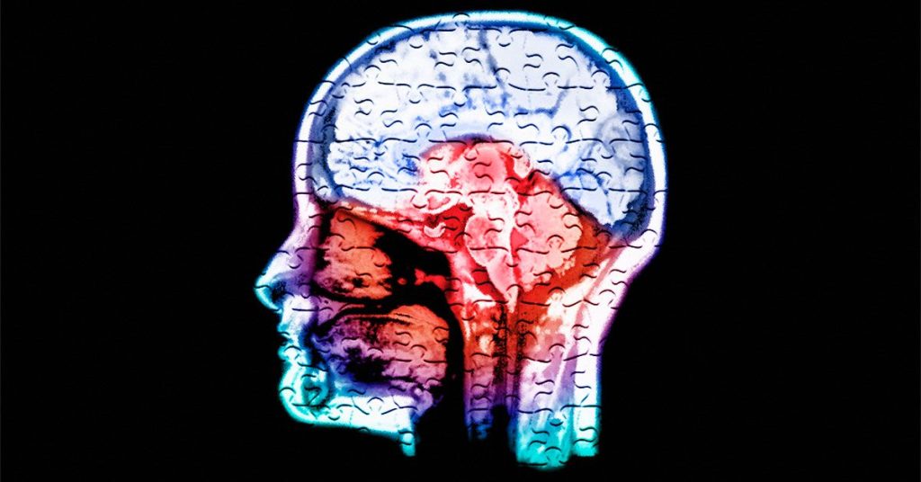 Low calcium, magnesium levels tied to poorer cognitive performance