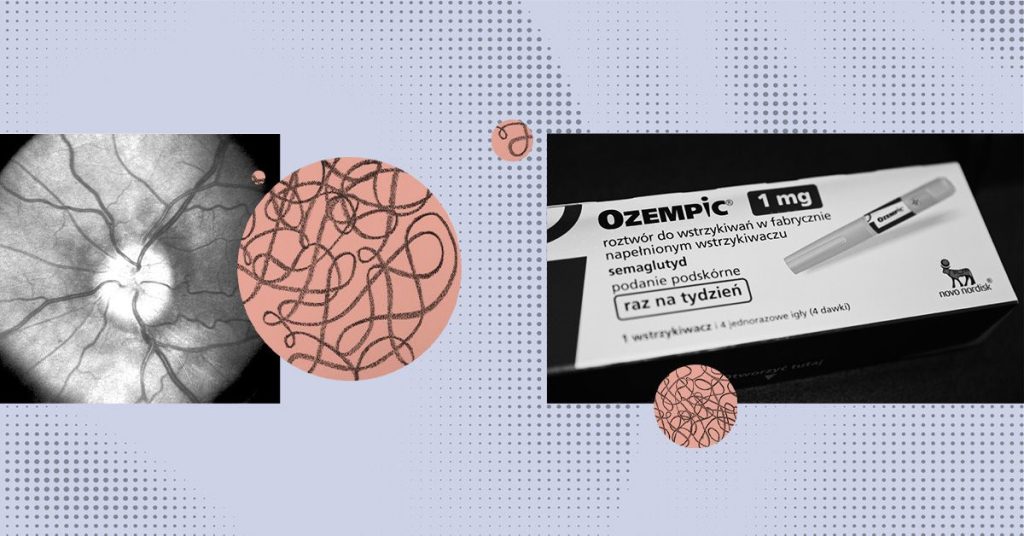 Danish studies find higher risk of optic nerve damage with Ozempic