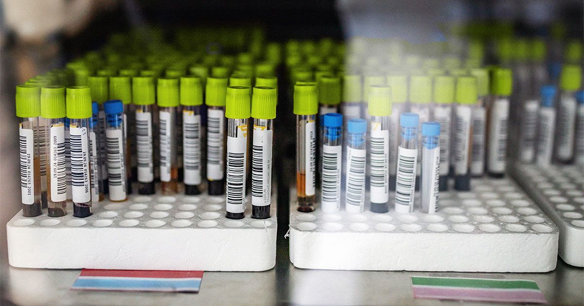 New Test May Predict Which Ibd Patients Have Higher Colorectal Cancer Risk