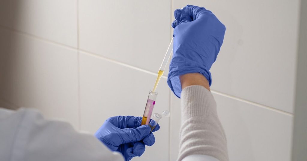 Simple Blood Cholesterol Test May Better Predict Coronary Artery Disease Risk