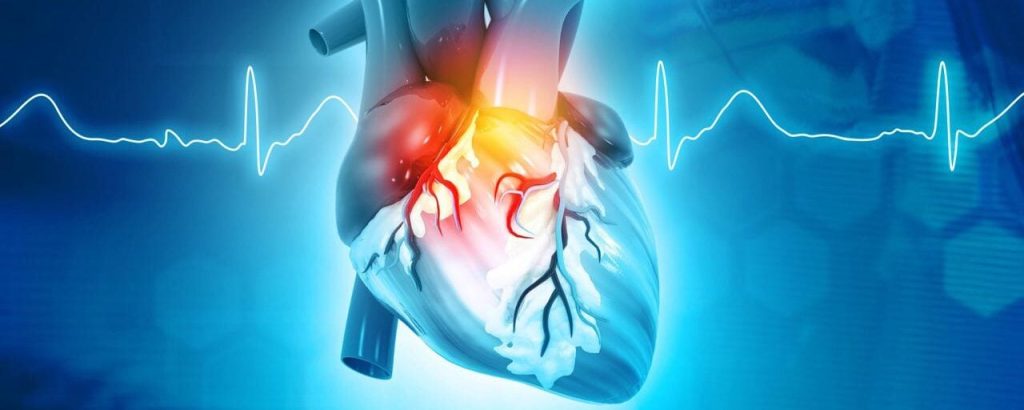 Fuoco di S.Antonio, infarto e ictus: un legame pericoloso