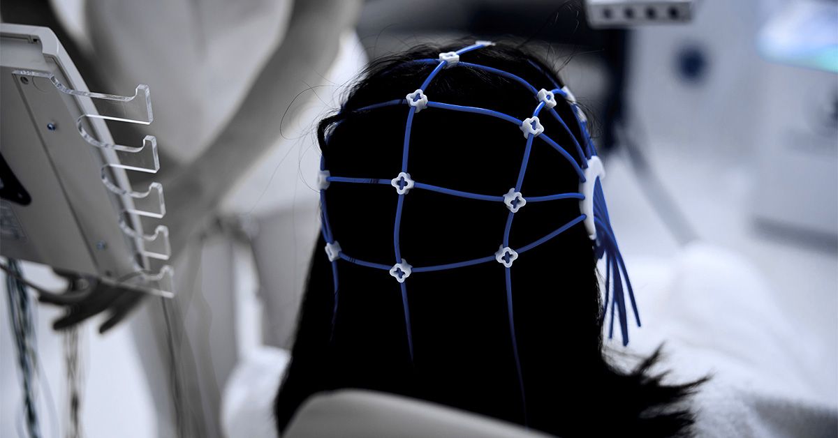 Can 3-minute non-diagnose test Alzheimer's Disease Early?