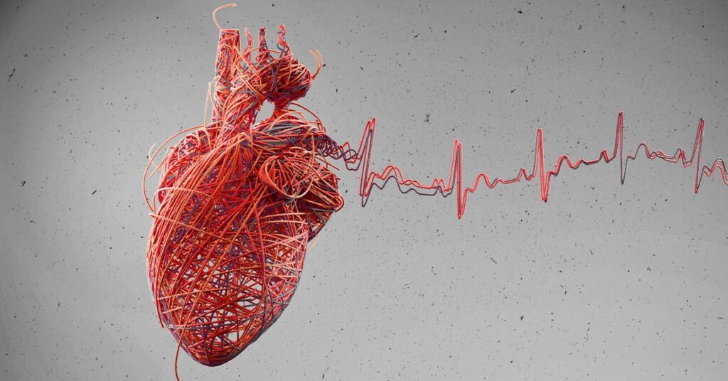 Heart Attacks May Be Linked To Bacterial Infections, Study Finds