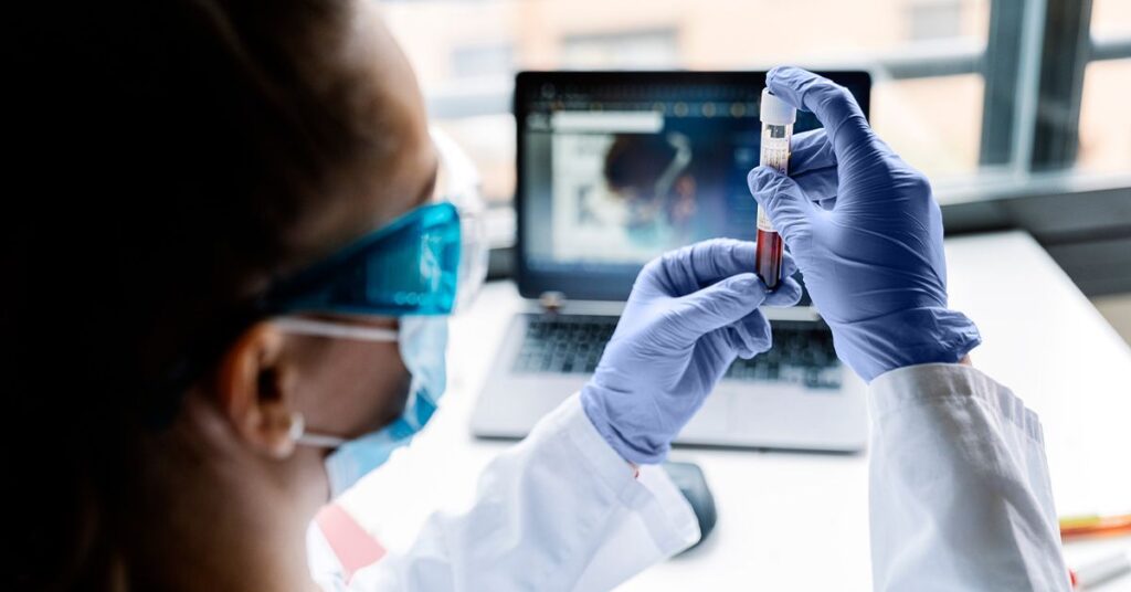 New blood test may help diagnose chronic fatigue syndrome with 96% accuracy