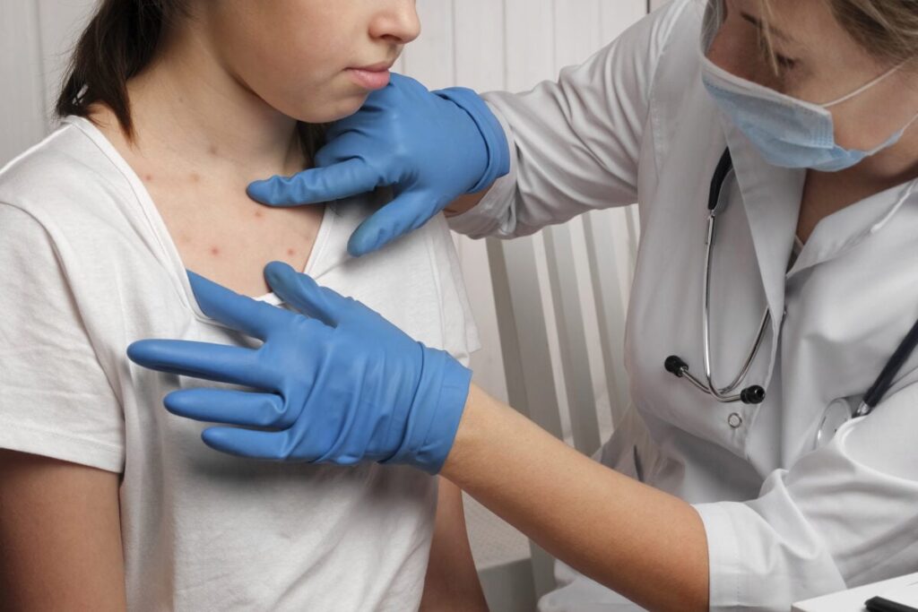 Usa, il ritorno del morbillo: “Siamo tornati indietro di 50 anni”