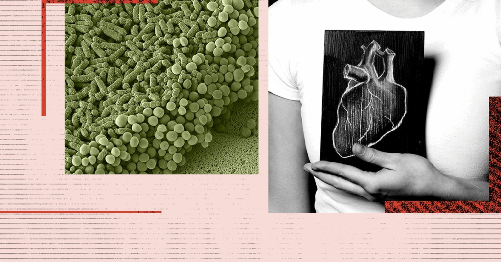 Changes in gut bacteria may be a warning sign of heart disease