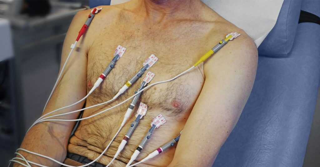 High levels of heart damage biomarker may signal increased dementia risk