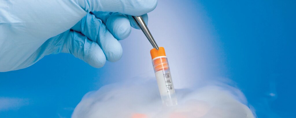 Maternità in freezer: ovociti, lavoro e la promessa (costosa) di fermare l’orologio biologico