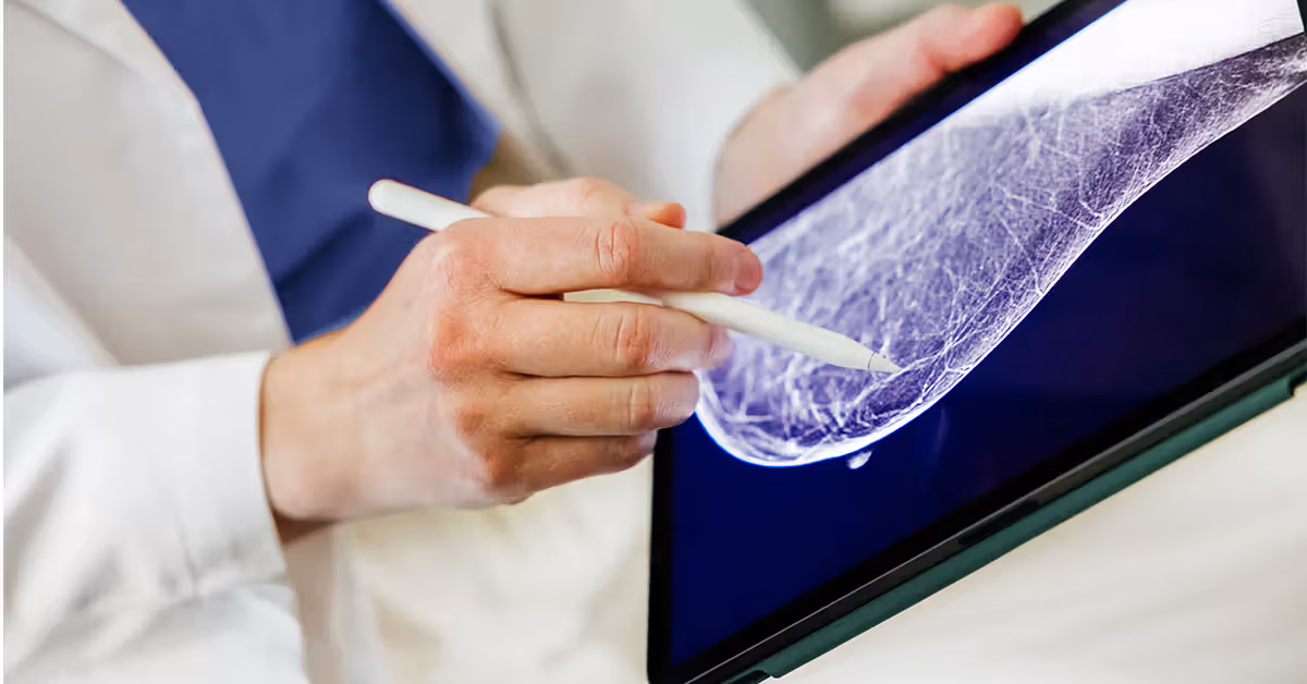 Routine mammograms may help predict heart disease, study suggests