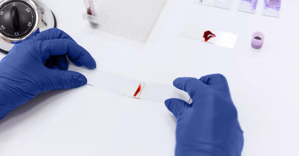 Blood test may predict dementia up to 25 years before symptom onset in women