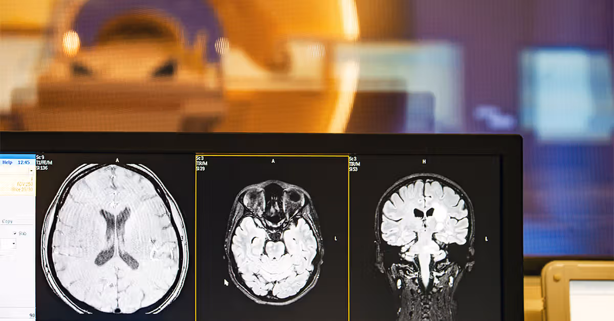 Could the gut be driving age-related memory loss?