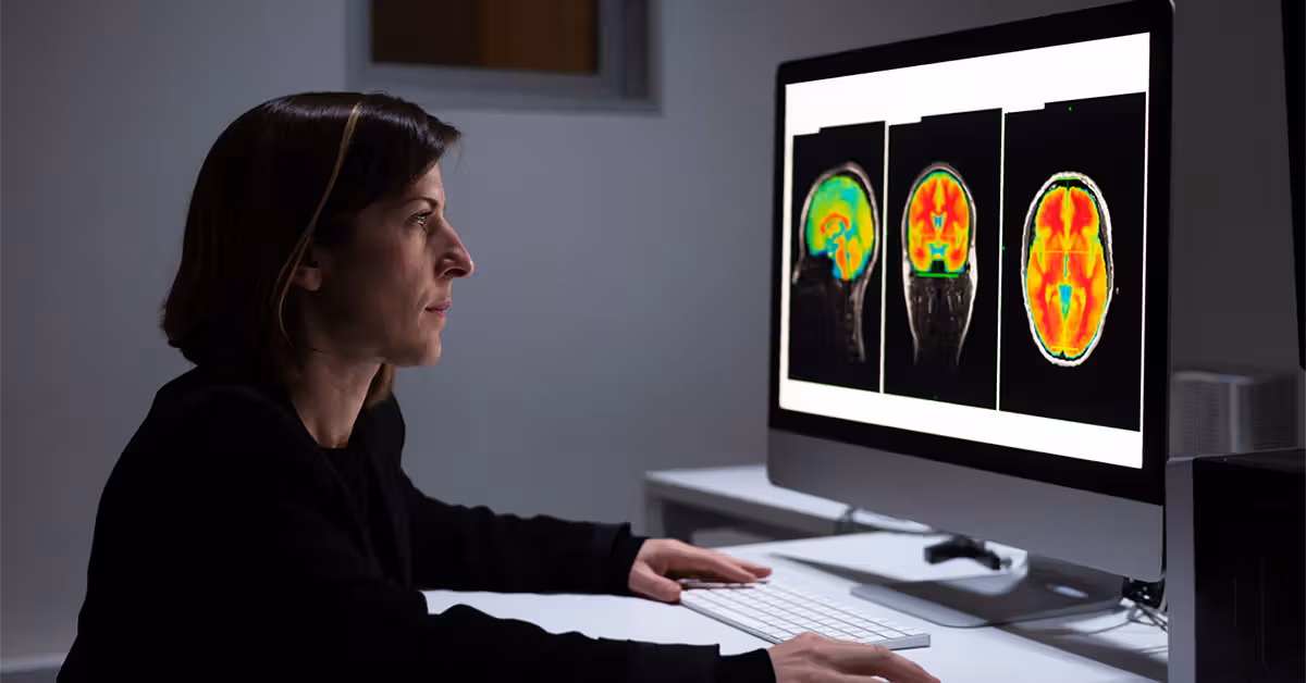 AI tool predicts Alzheimer's disease with nearly 93% accuracy using brain scans