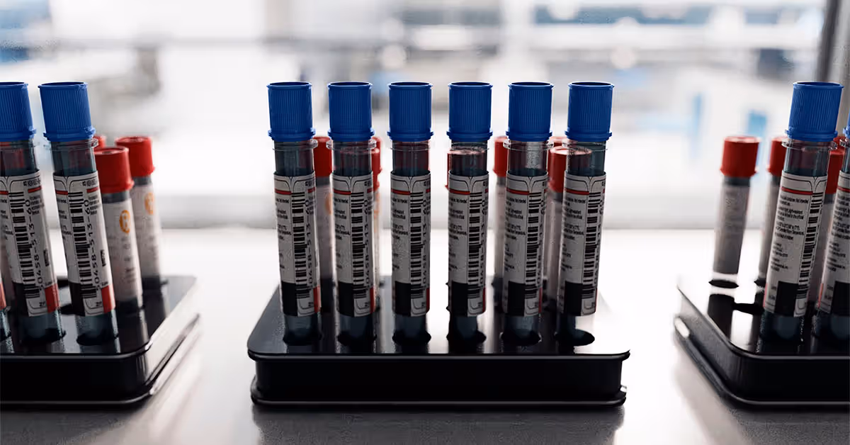 Blood test may be more effective and cost-efficient than standard cholesterol tests