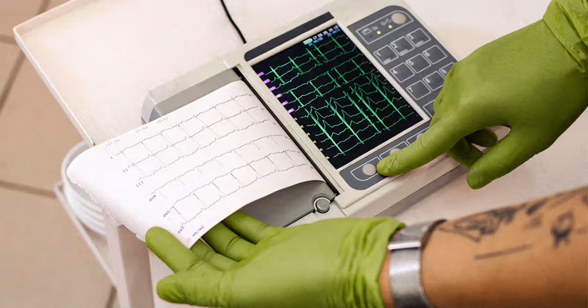 High lipoprotein(a) levels tied to persistent cardiovascular risk, study finds