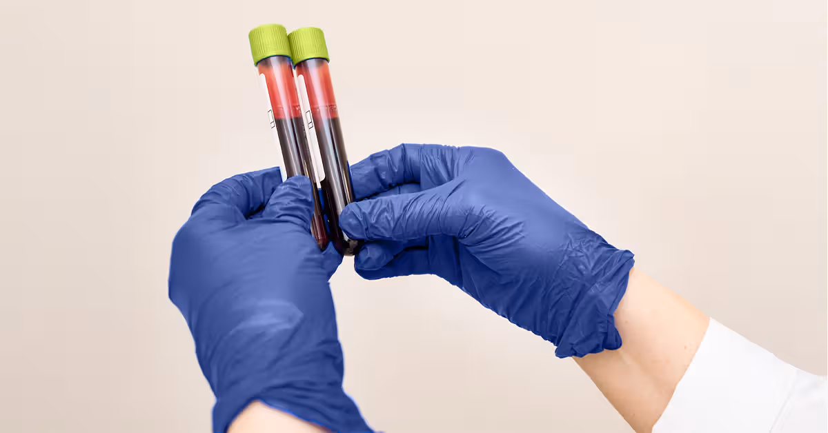 Alzheimer's blood test around ages 53-69 may help detect early cognitive decline