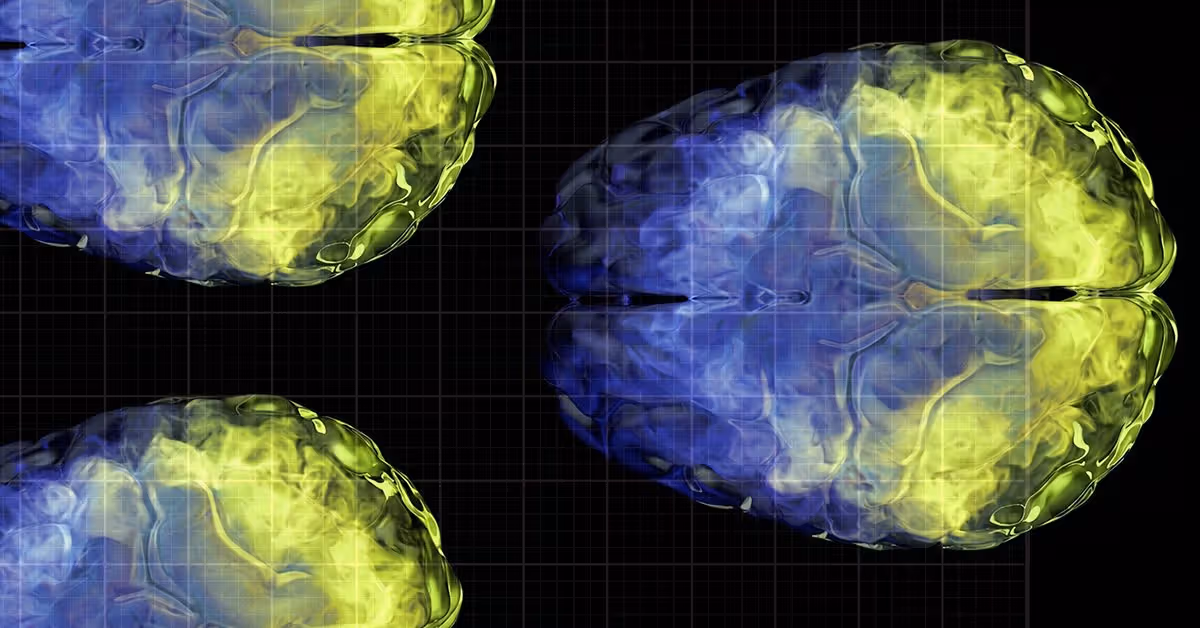 Vitamin C may help preserve brain gray matter volume as we age