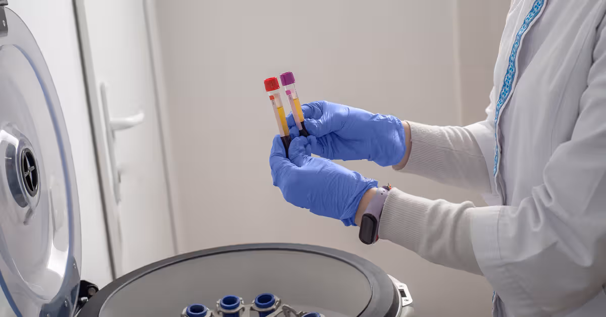 New RNA-based blood test shows promise for earlier Alzheimer's detection