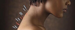 Salute in punta di ago: ecco perché l’agopuntura non è più una medicina alternativa