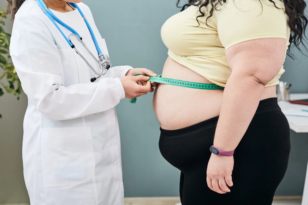 Obesità, cresce soprattutto tra i giovani: boom di casi nelle donne under 35