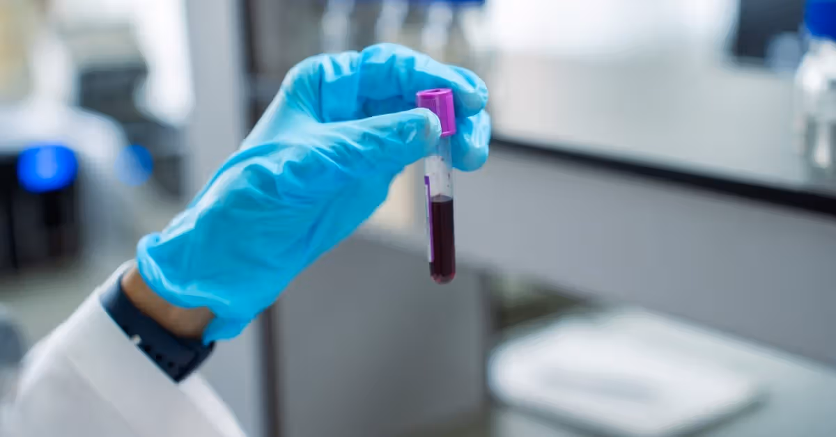 AI-enhanced biomarker blood test may detect pancreatic cancer earlier, study suggests