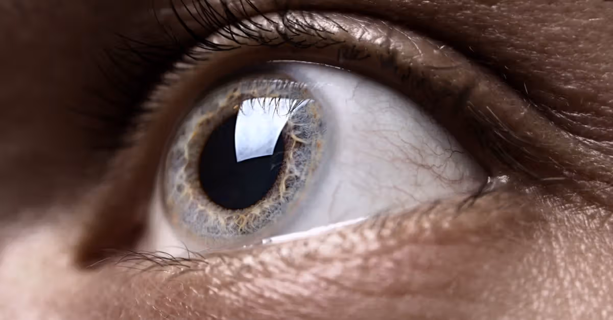 How changes in the eyes may help spot AFib risk years early