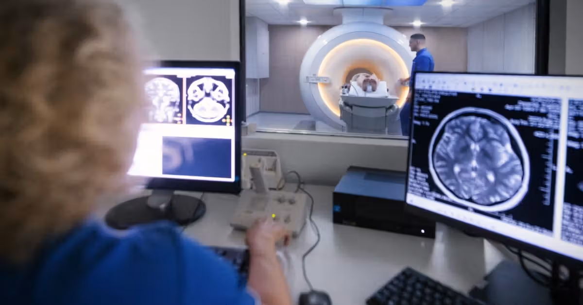 AI complements radiologists to help improve brain aneurysm detection