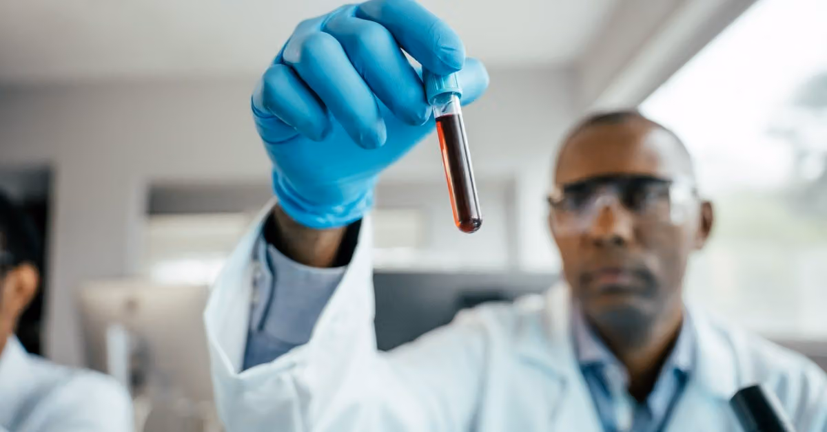 Blood test may detect lung cancer recurrence months before scans