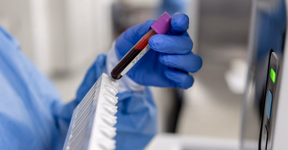 Prostate cancer risk may be detectable in blood 15 years before diagnosis